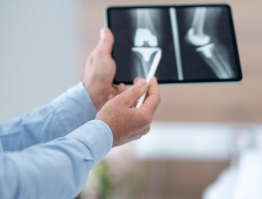 Röntgenbild von einem künstlichen Kniegelenk