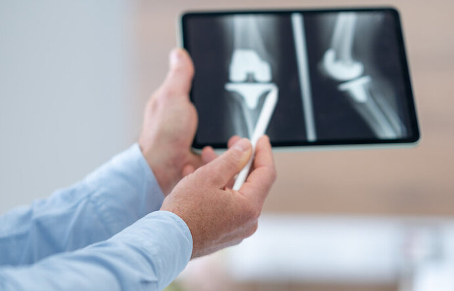 Hände eines Arztes halten Tablet mit Röntgenbild eines künstlichen Kniegelenks, mit einem Kugelschreiber in der rechten Hand erklärt er die Aufnahme